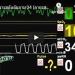 ตัฟซีร ซูเราะฮฺอัลอันอาม 34 (อายะฮฺ 61-62)